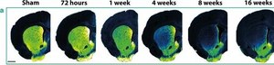Anti-Tyrosine Hydroxylase Antibody, clone LNC1 ascites fluid, clone LNC1, Chemicon&#174;