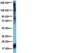 Anticorps anti-phosphothréonine Chemicon&#174;, from rabbit