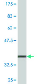 Monoclonal Anti-PEX6 antibody produced in mouse clone 3G3, purified immunoglobulin, buffered aqueous solution