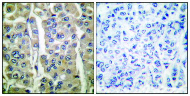 Anti-Involucrin antibody produced in rabbit affinity isolated antibody