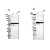 Anti-PDIA3 antibody produced in rabbit Ab2, Prestige Antibodies&#174; Powered by Atlas Antibodies, affinity isolated antibody, buffered aqueous glycerol solution