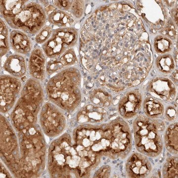 Anti-PKIB antibody produced in rabbit Prestige Antibodies&#174; Powered by Atlas Antibodies, affinity isolated antibody, buffered aqueous glycerol solution