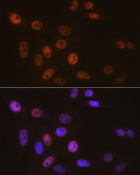 Anti- SMARCB1/SNF5 antibody produced in rabbit