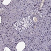 Anti-LUM antibody produced in rabbit Prestige Antibodies&#174; Powered by Atlas Antibodies, affinity isolated antibody, buffered aqueous glycerol solution