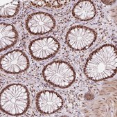 Anti-U2AF2 antibody produced in rabbit Prestige Antibodies&#174; Powered by Atlas Antibodies, affinity isolated antibody, buffered aqueous glycerol solution