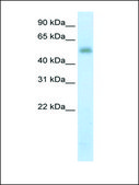 Anti-METTL3 (AB2) antibody produced in rabbit IgG fraction of antiserum