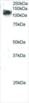 Anti-CBL antibody produced in goat affinity isolated antibody, buffered aqueous solution