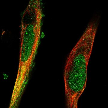 Anti-TRIM36 antibody produced in rabbit Prestige Antibodies&#174; Powered by Atlas Antibodies, affinity isolated antibody