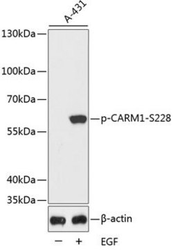 Anti-Phospho-CARM1-S228 antibody produced in rabbit