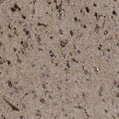 Anti-HACD3 antibody produced in rabbit Prestige Antibodies&#174; Powered by Atlas Antibodies, affinity isolated antibody, buffered aqueous glycerol solution