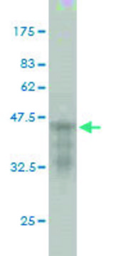 Monoclonal Anti-CDKL5 antibody produced in mouse clone 1D9, purified immunoglobulin, buffered aqueous solution