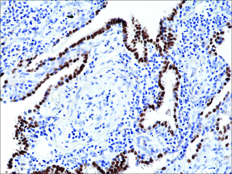 Anti-TTF1 (Thyroid transcription factor 1) antibody, Rabbit monoclonal recombinant, expressed in HEK 293 cells, clone RM373, purified immunoglobulin