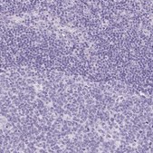 Anti-CLDN16 antibody produced in rabbit Prestige Antibodies&#174; Powered by Atlas Antibodies, affinity isolated antibody, buffered aqueous glycerol solution