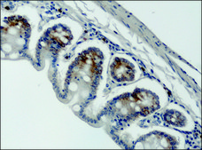 Anti-DSCR1 (C-terminal) antibody produced in rabbit ~1.5&#160;mg/mL, affinity isolated antibody, buffered aqueous solution