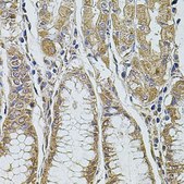 Anti-ALIX/PDCD6IP antibody produced in rabbit