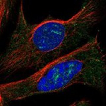 Anti-CLN6 antibody produced in rabbit Prestige Antibodies&#174; Powered by Atlas Antibodies, affinity isolated antibody, buffered aqueous glycerol solution