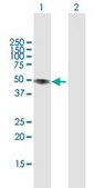 Anti-LIPA antibody produced in rabbit purified immunoglobulin, buffered aqueous solution