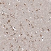 Anti-PPP2R3A antibody produced in rabbit Prestige Antibodies&#174; Powered by Atlas Antibodies, affinity isolated antibody, buffered aqueous glycerol solution