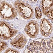 Anti-HIP1R antibody produced in rabbit Prestige Antibodies&#174; Powered by Atlas Antibodies, affinity isolated antibody, buffered aqueous glycerol solution