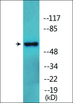Anti-phospho-LCK (pSer59) antibody produced in rabbit affinity isolated antibody