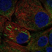 Anti-IMPDH2 antibody produced in rabbit Prestige Antibodies&#174; Powered by Atlas Antibodies, affinity isolated antibody, buffered aqueous glycerol solution
