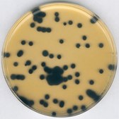 Clostridium perfringens selective supplement For the preparation of TSC Agar, For the enumeration of Clostridium perfringens