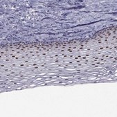Anti-TRPS1 Prestige Antibodies&#174; Powered by Atlas Antibodies, affinity isolated antibody