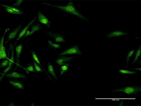 Anti-CACNB3 antibody produced in rabbit purified immunoglobulin, buffered aqueous solution