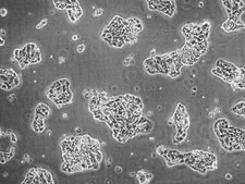 Calu-3 Human Lung Adenocarcinoma Cell Line