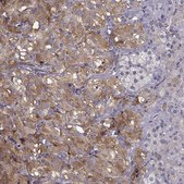 Anti-SLC18A1 antibody produced in rabbit Prestige Antibodies&#174; Powered by Atlas Antibodies, affinity isolated antibody