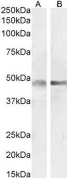 Anti-GFAP antibody produced in goat affinity isolated antibody, buffered aqueous solution