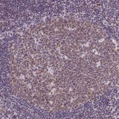 Monoclonal Anti-RBM3 antibody produced in mouse Prestige Antibodies&#174; Powered by Atlas Antibodies, clone CL0296, purified immunoglobulin, buffered aqueous glycerol solution