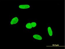 Monoclonal Anti-DDX26 antibody produced in mouse clone 3D9, purified immunoglobulin, buffered aqueous solution