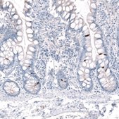Anti-CHAT antibody produced in rabbit Prestige Antibodies&#174; Powered by Atlas Antibodies, affinity isolated antibody, buffered aqueous glycerol solution