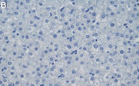 Anti-SOD1 Antibody, clone 1G13 ZooMAb&#174; Mouse Monoclonal recombinant, expressed in HEK 293 cells