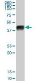 Anti-HLA-A antibody produced in mouse purified immunoglobulin, buffered aqueous solution