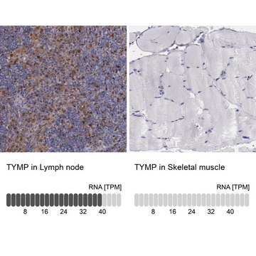 Anti-TYMP antibody produced in rabbit Prestige Antibodies&#174; Powered by Atlas Antibodies, affinity isolated antibody, buffered aqueous glycerol solution