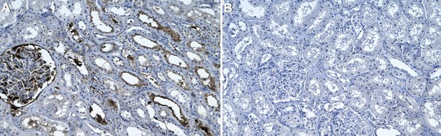 Anti-Fibrin Antibody, clone 59D8 ZooMAb&#174; Mouse Monoclonal recombinant, expressed in HEK 293 cells