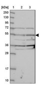 Anti-NARFL antibody produced in rabbit Prestige Antibodies&#174; Powered by Atlas Antibodies, affinity isolated antibody, buffered aqueous glycerol solution
