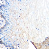 Anti-S100A10 Antibody, clone 6X8F7, Rabbit Monoclonal
