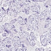 Anti-DEFA5 antibody produced in rabbit Prestige Antibodies&#174; Powered by Atlas Antibodies, affinity isolated antibody, buffered aqueous glycerol solution