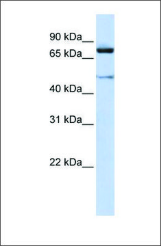 Anti-CUL2 antibody produced in rabbit affinity isolated antibody