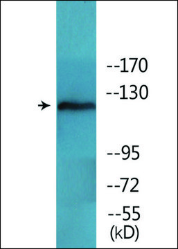 Anti-phospho-FAK (pTyr397) antibody produced in rabbit affinity isolated antibody