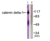 Anti-Catenin-&#948;1 antibody produced in rabbit affinity isolated antibody