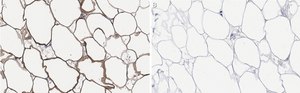 Anti-FASN Antibody, clone 2C13 ZooMAb&#174; Rabbit Monoclonal recombinant, expressed in HEK 293 cells