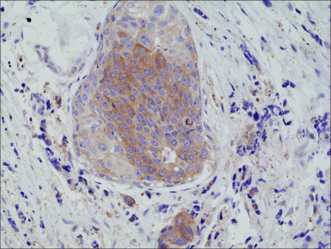 Anti-eIF-2 alpha (Ser51) antibody, Rabbit Monoclonal recombinant, expressed in HEK 293 cells, clone RM298, purified immunoglobulin