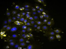 MOC2 Mouse Oral Squamous Cell Carcinoma (OSCC) Cell Line