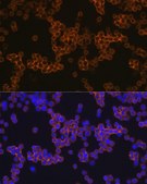 Anti-CD14 antibody produced in rabbit