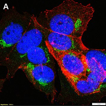 Anti-&#945;-amylase Antibody, clone 1G14 ZooMAb&#174; Rabbit Monoclonal recombinant, expressed in HEK 293 cells