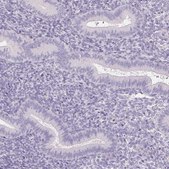 Anti-ACPP antibody produced in rabbit Prestige Antibodies&#174; Powered by Atlas Antibodies, affinity isolated antibody, buffered aqueous glycerol solution